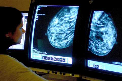 NHS mishap leads to over 5,000 Brits missing lifesaving cancer checks