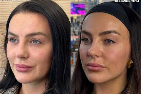 Love Island's Rosie Williams Unveils Stunning New Look After Dissolving Fillers