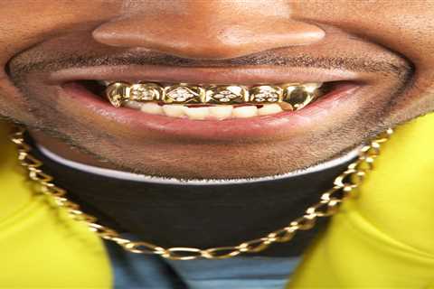 Bustling Market for Gold Teeth as Brits Seek Extra Funds