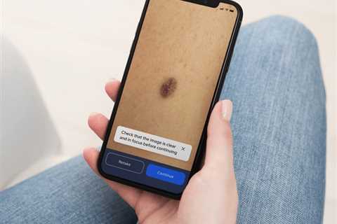 New Revolutionary Phone App Could Detect Deadly Skin Cancer as Cases Surge