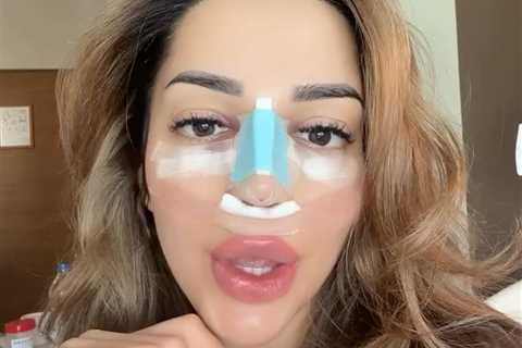 Love Island's Tanyel Revan reveals the result of her nose job after jetting to Turkey for surgery