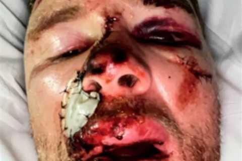 Freddie Flintoff's Top Gear Crash: Unveiling Severe Injuries in New Documentary