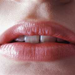 Decoding Lip Health: Insights into Your Well-being Beyond Lipstick