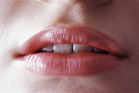 Decoding Lip Health: Insights into Your Well-being Beyond Lipstick